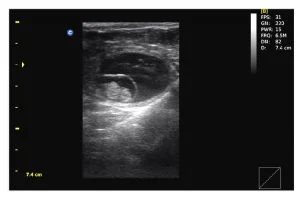 bovino-pregnancy.jpg
