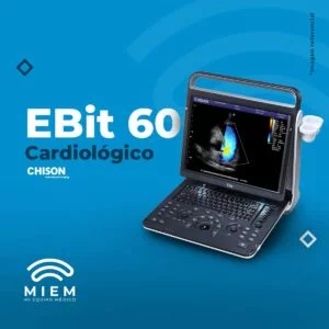 Chison Ebit 60