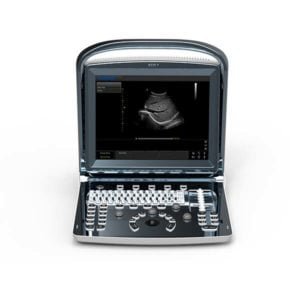 Chison ECO 1 portátil