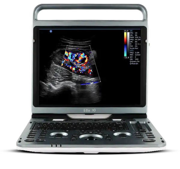 Chison Ebit 30 doppler color